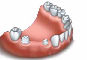 Restorative Dentist Bloor West Village