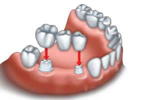 Restorative Dentist Bloor West Village