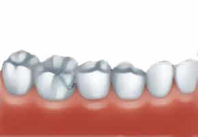 Cosmetic Dentist in Bloor West