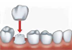 Cosmetic Dentist in Bloor West
