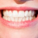 How to Improve Your Dental Health